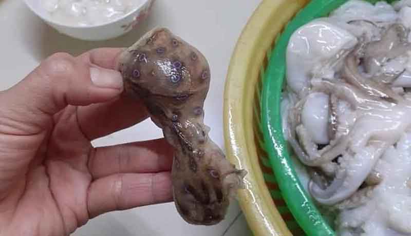 Tai nạn thường gặp khi đi du lịch, ai cũng nên biết để tránh hại thân-2