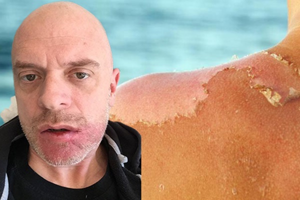 Các bác sĩ ung thư nói về 6 loại thực phẩm nên hạn chế: Toàn món thường thấy, nhiều người ‘khoái’ ăn-6