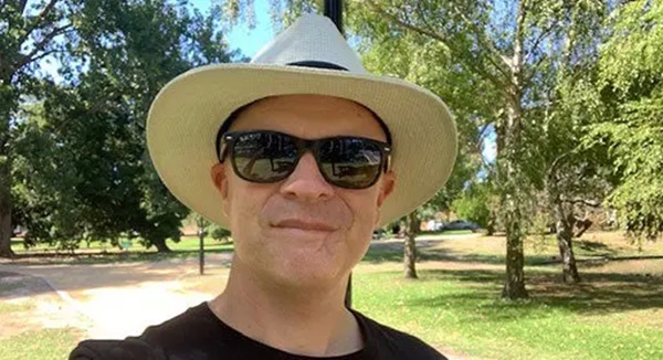 Người đàn ông mắc ung thư da nặng vì 1 thói quen nhiều người mắc vào mùa hè-1