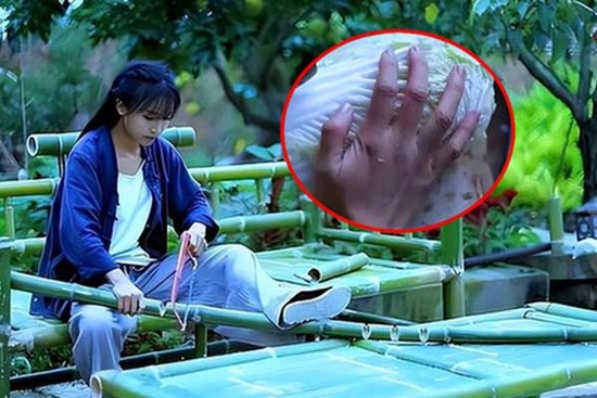 Bàn tay đầy sẹo sần sùi của 
