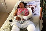 TPHCM: Ô tô cháy nổ, người phụ nữ bị bỏng nặng-2