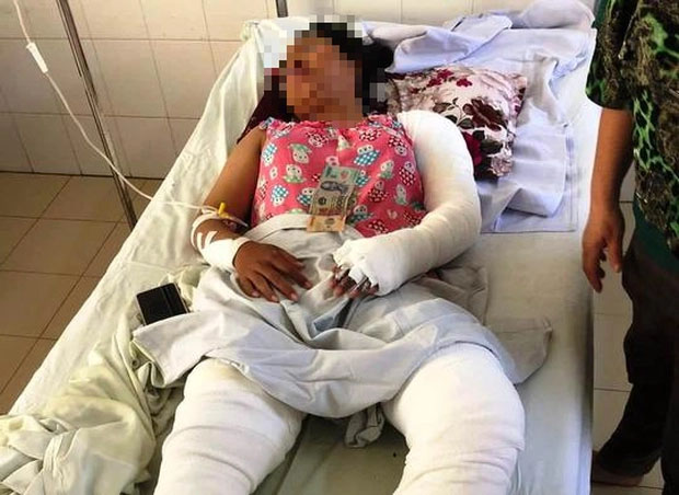 Mâu thuẫn, mẹ kế tẩm xăng đốt sách vở con riêng khiến 4 người bỏng nặng-1