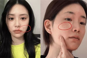 Bác sĩ chỉ ra 5 lỗi skincare phổ biến khiến da lão hóa không phanh