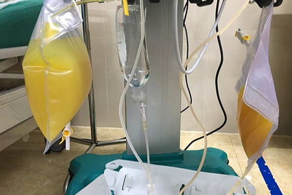 Gần 2 lít dầu” trong máu người phụ nữ, không dám tin mình suýt mất mạng vì 1 món khoái khẩu từ thịt lợn-2