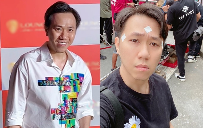 Ngoại hình của diễn viên Anh Đức thay đổi ra sao mà gây tranh cãi?-3