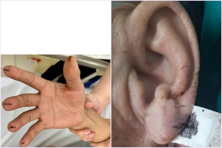 7 việc cần làm khi sơ cứu người bị đột quỵ não-1