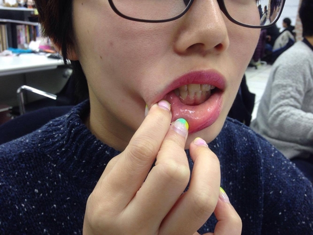 3 hành vi làm nguy cơ ung thư miệng tăng vọt gấp cả trăm lần nhưng rất nhiều người mắc phải mà không biết-3