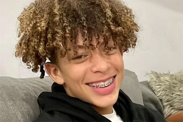 Nam sinh Mỹ bốc cháy như ngọn đuốc vì bắt chước trào lưu mạng-3