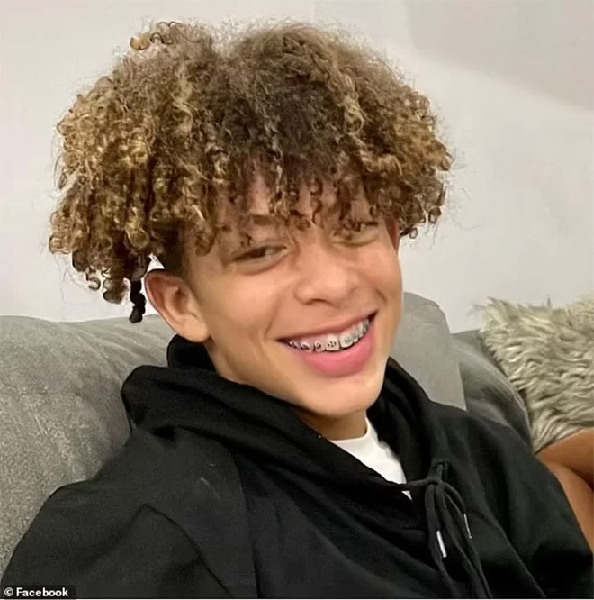 Nghịch dại theo thử thách trên TikTok, nam sinh 16 tuổi bỏng 75% cơ thể-2