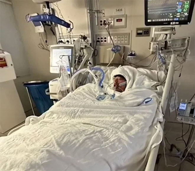 Nghịch dại theo thử thách trên TikTok, nam sinh 16 tuổi bỏng 75% cơ thể-1