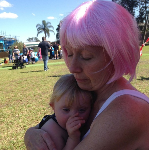 Nhờ thói quen của con gái mắc bệnh Down, người mẹ phát hiện bị ung thư, hành trình chữa bệnh thật đáng khâm phục-4