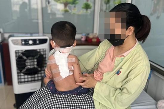 Phát hiện mắc bệnh hiếm từ mảng da màu đen ở lưng