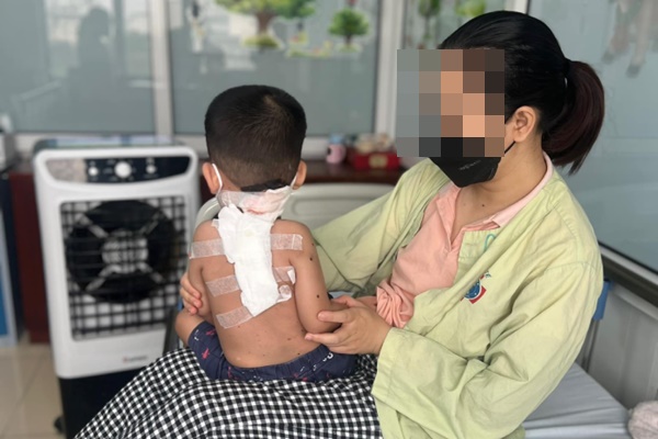 Phát hiện mắc bệnh hiếm từ mảng da màu đen ở lưng-1