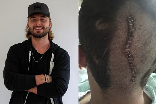 Chàng trai Mỹ suýt mất mạng sau một cái hắt hơi