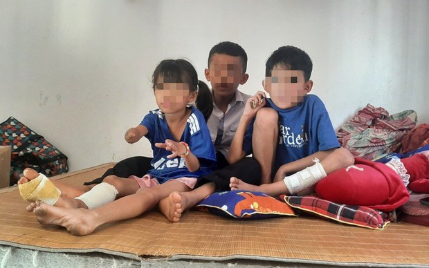 Sức khoẻ của 3 nạn nhân nhỏ tuổi trong vụ nổ kinh hoàng tại Nghệ An sau hơn 1 tháng điều trị-1