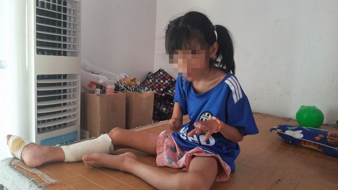 Sức khoẻ của 3 nạn nhân nhỏ tuổi trong vụ nổ kinh hoàng tại Nghệ An sau hơn 1 tháng điều trị-3