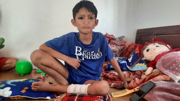 Sức khoẻ của 3 nạn nhân nhỏ tuổi trong vụ nổ kinh hoàng tại Nghệ An sau hơn 1 tháng điều trị-4