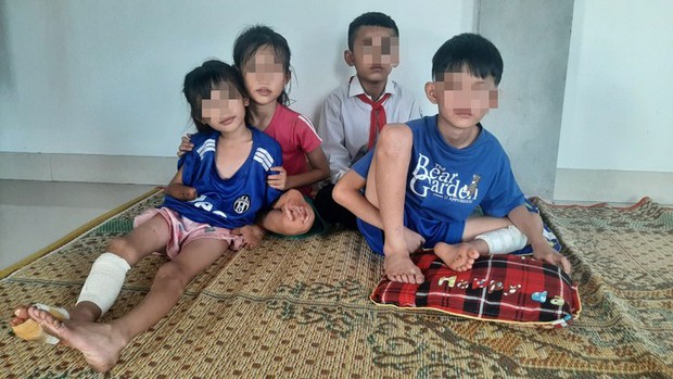 Sức khoẻ của 3 nạn nhân nhỏ tuổi trong vụ nổ kinh hoàng tại Nghệ An sau hơn 1 tháng điều trị-6