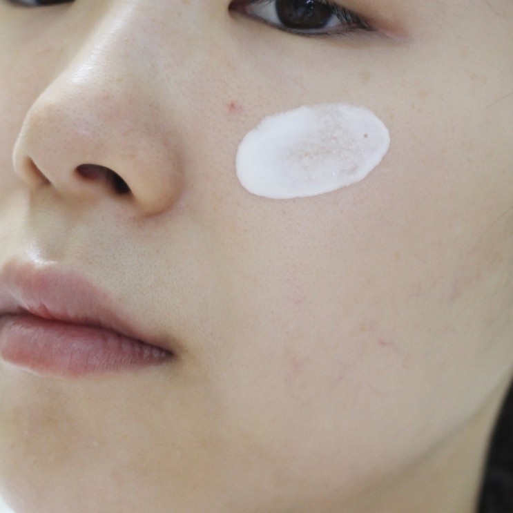 Sự thật khi bôi kem chống nắng trong mùa hè, không biết rất dễ dẫn đến sạm, nhăn da-2