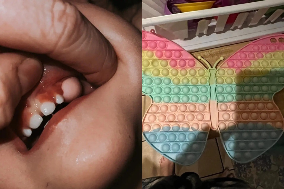 Món đồ chơi phổ biến gây nguy hiểm đến tính mạng của trẻ-1