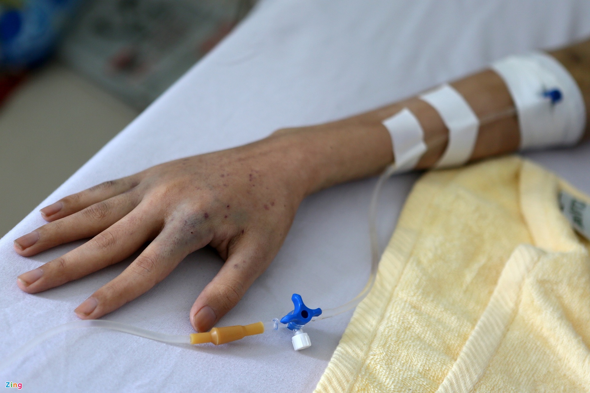 Lý do khiến ngày càng nhiều người Việt phát hiện mắc ung thư-1