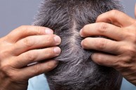 Tên cướp táo tợn sa lưới vì những mảnh gầu trong chiếc tất chùm đầu
