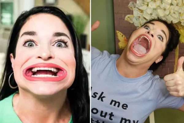 Nấu theo mẹo trên TikTok, người phụ nữ Anh bị bỏng nửa mặt-4