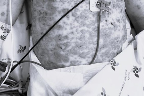 Người phụ nữ tỉnh lại sau khi nhân viên y tế tuyên bố đã qua đời-1