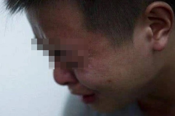 Người đàn ông 32 tuổi mắc ung thư gan, bác sĩ cảnh báo thực phẩm này còn độc hơn hút thuốc, uống rượu-1