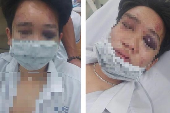 Vụ nam sinh bị bạn đánh vỡ xương trán: