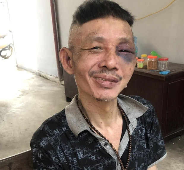 Bắt giữ đối tượng nghi ngáo đá, thường xuyên quậy phá hàng xóm-1