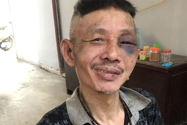 Cô gái 19 tuổi nghi ngáo đá tự đốt căn hộ chung cư ở TP.HCM-2