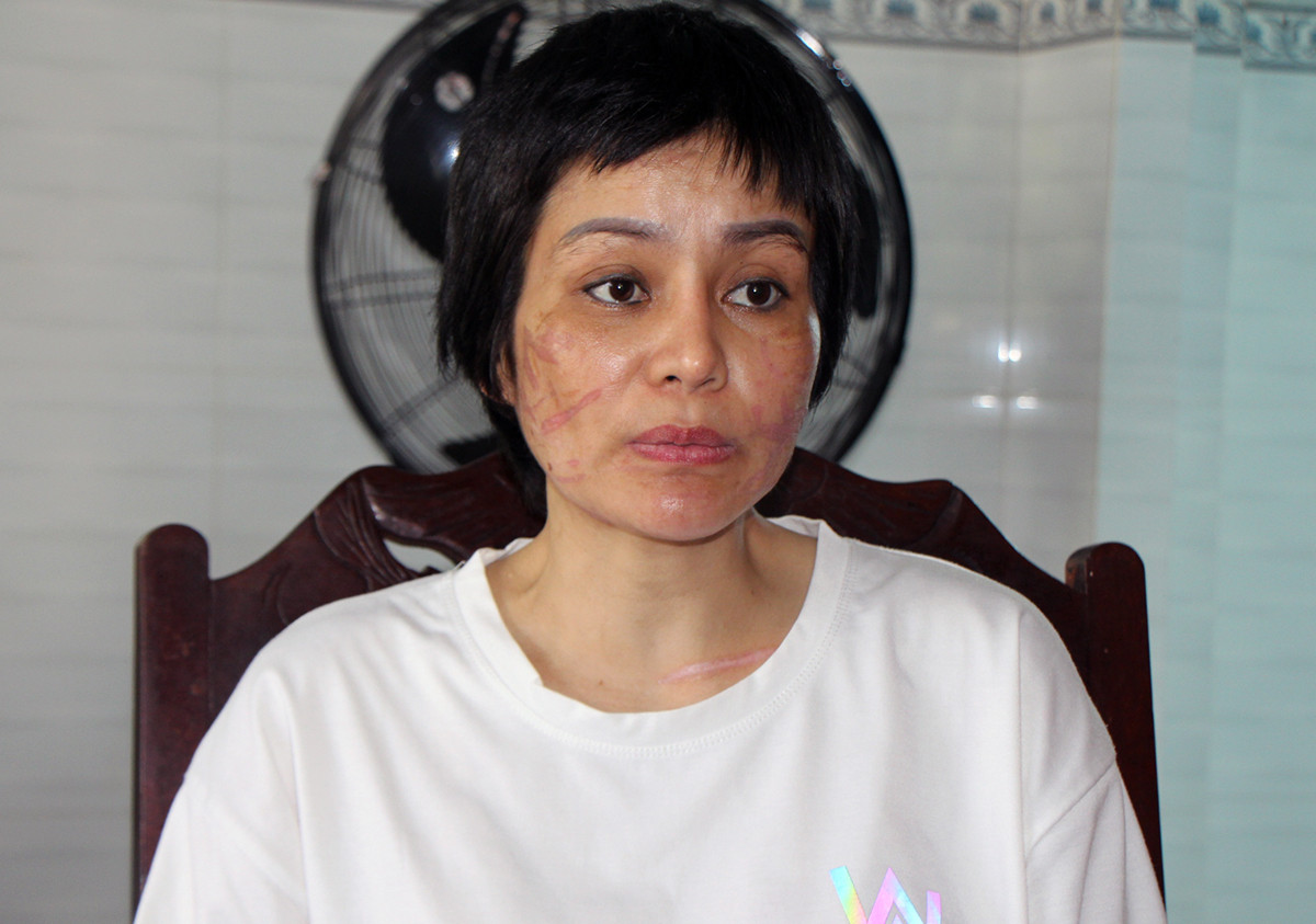 Người phụ nữ mang bầu 7 tháng bị chồng bạo hành dã man-7