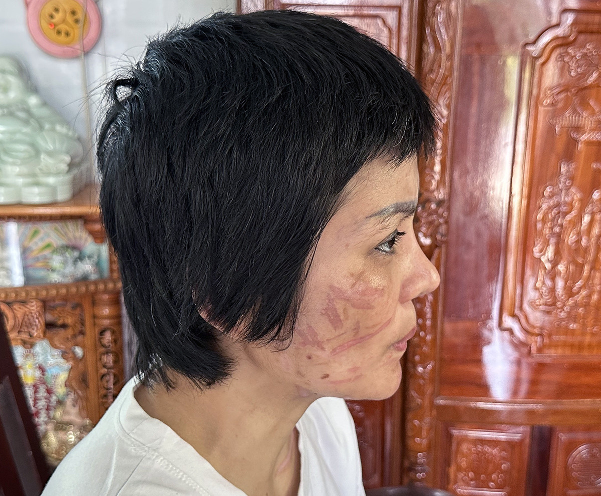 Người phụ nữ mang bầu 7 tháng bị chồng bạo hành dã man-5