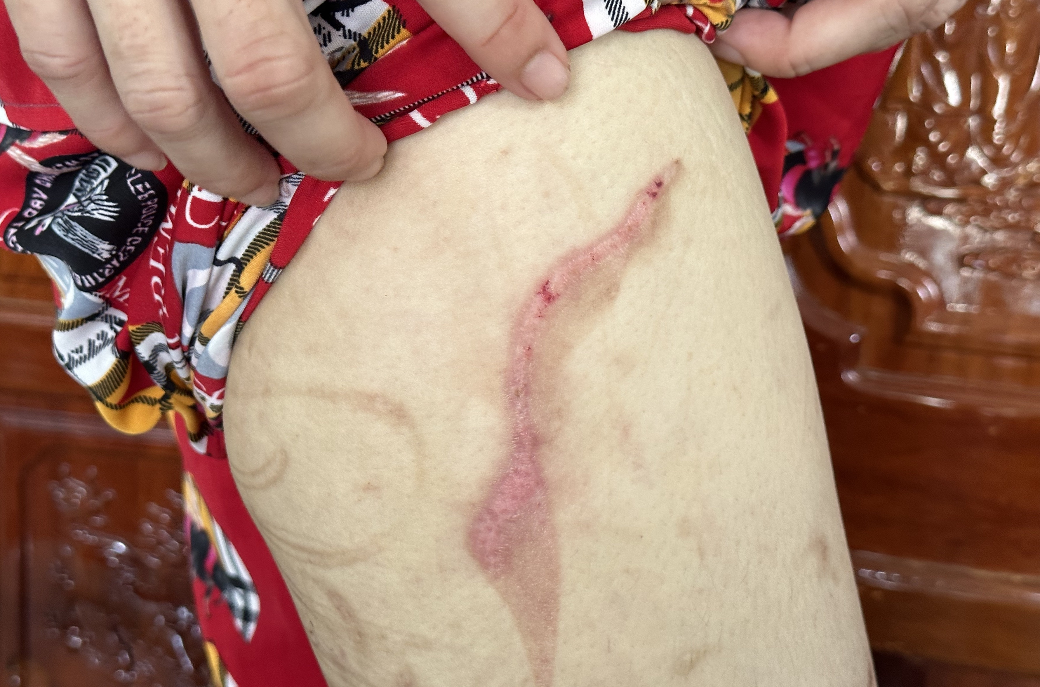 Người phụ nữ mang bầu 7 tháng bị chồng bạo hành dã man-6