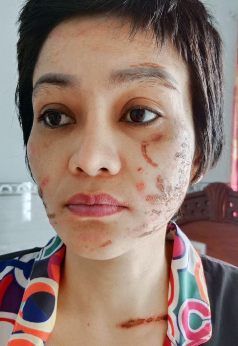 Người phụ nữ mang bầu 7 tháng bị chồng bạo hành dã man-2