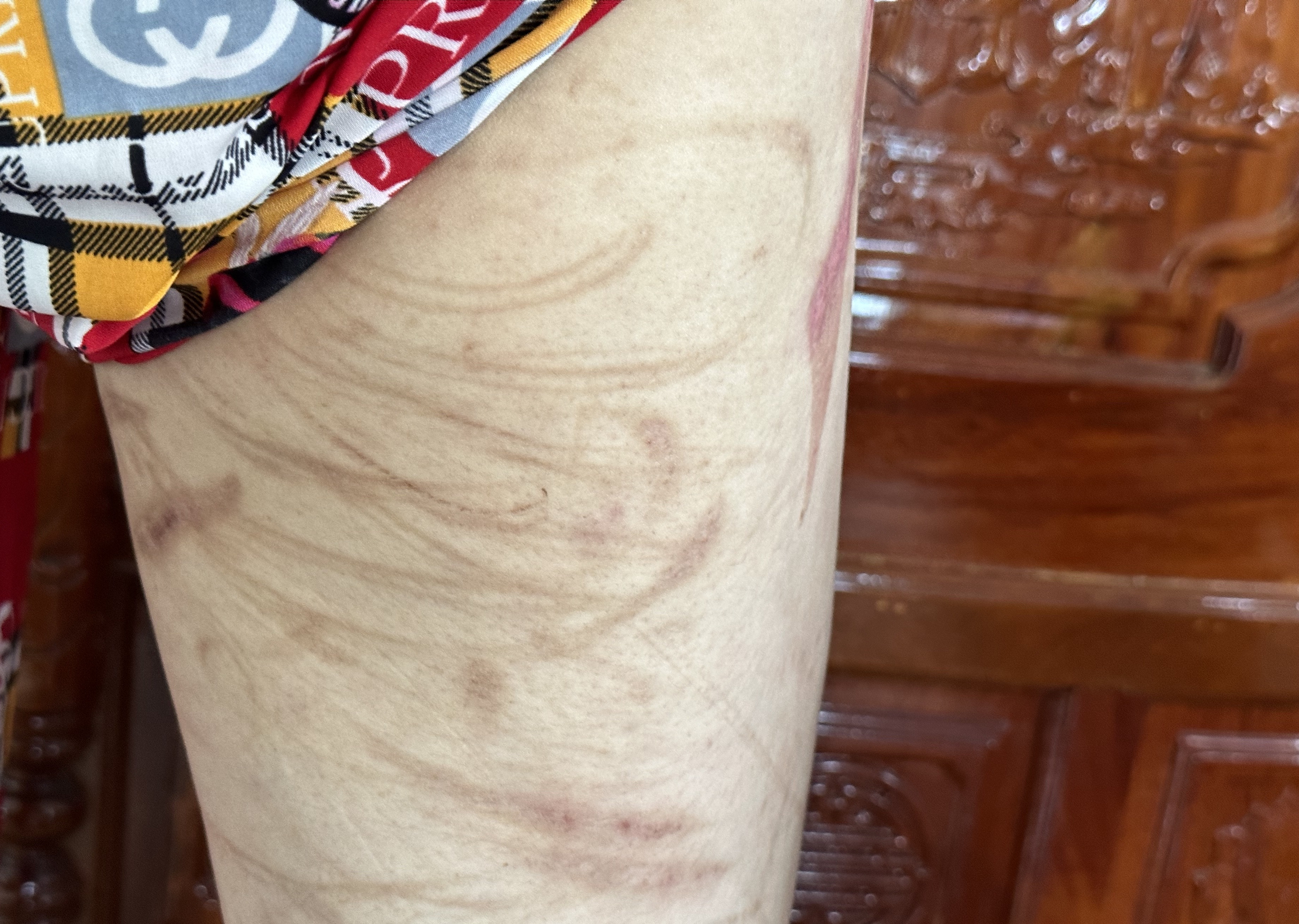 Người phụ nữ mang bầu 7 tháng bị chồng bạo hành dã man-4