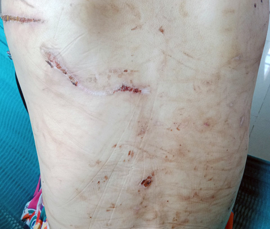 Người phụ nữ mang bầu 7 tháng bị chồng bạo hành dã man-3