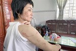 Thai phụ Kiên Giang bị chồng bạo hành: Anh ta nói đánh cho tôi chết từ từ-7