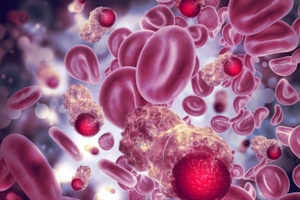 Cảnh báo: Điều nhiều người xem nhẹ có thể kích hoạt ung thư máu-1