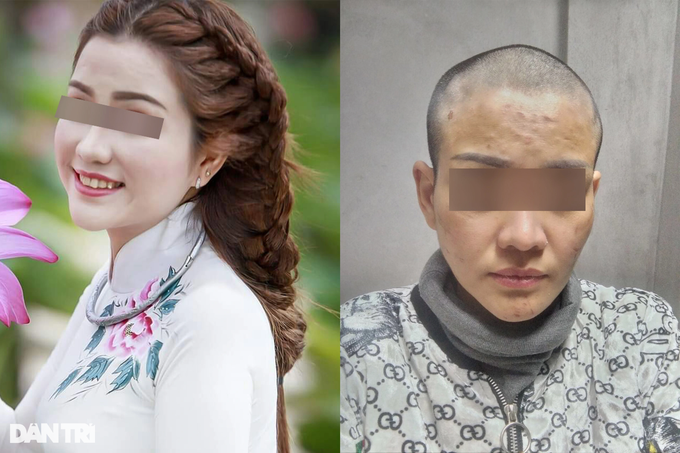 Thai phụ Kiên Giang bị chồng bạo hành: Anh ta nói đánh cho tôi chết từ từ-1