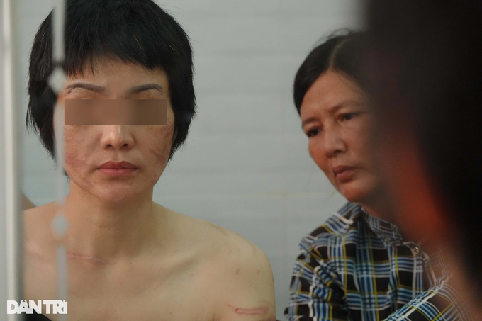 Thai phụ Kiên Giang bị chồng bạo hành: Anh ta nói đánh cho tôi chết từ từ-3