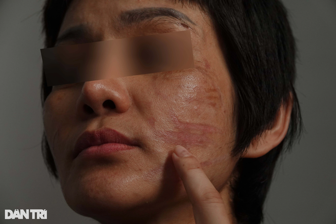 Thai phụ Kiên Giang bị chồng bạo hành: Anh ta nói đánh cho tôi chết từ từ-4