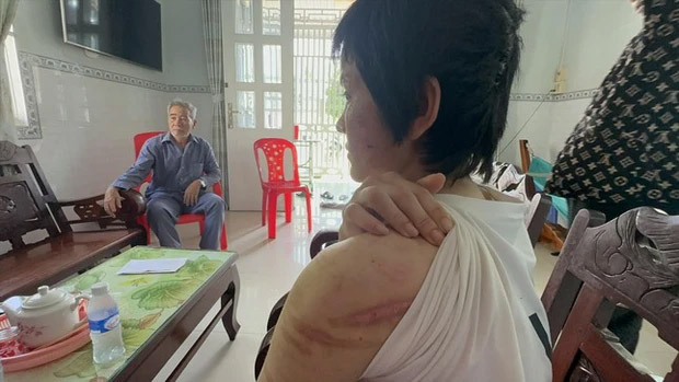 Thai phụ bị chồng bạo hành và cuộc tháo chạy khỏi địa ngục-1