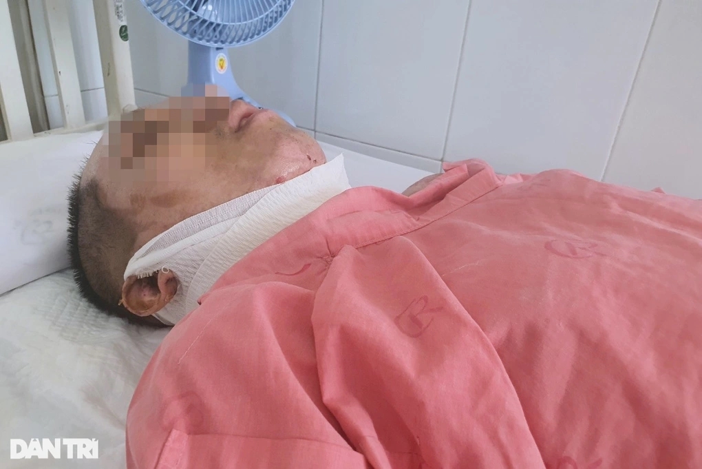 Nướng mực đãi tiệc cho thai phụ sắp sinh, 3 người trong nhà bỏng thương tâm-3