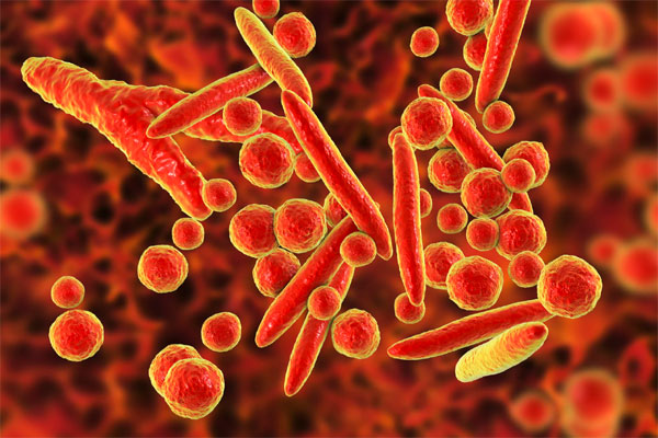 Thời tiết diễn biến bất thường, ghi nhận loại viêm phổi nguy hiểm-1