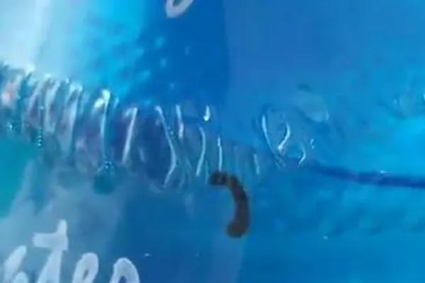 Tìm thấy con đỉa dài 10cm trong dương vật người đàn ông-2