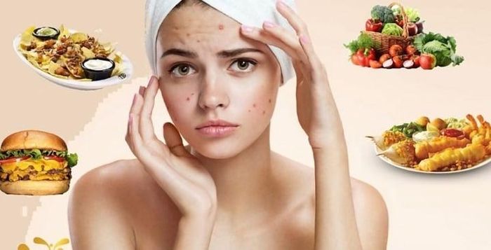 Mùa hè ăn gì để da khỏe đẹp, tránh nổi mụn?-1