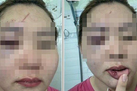 Thầy giáo ở Đắk Lắk thừa nhận hành vi đánh vợ nhập viện