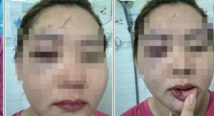 Thầy giáo ở Đắk Lắk thừa nhận hành vi đánh vợ nhập viện-1